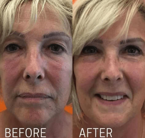 PHOTO 2021 12 01 19 15 05